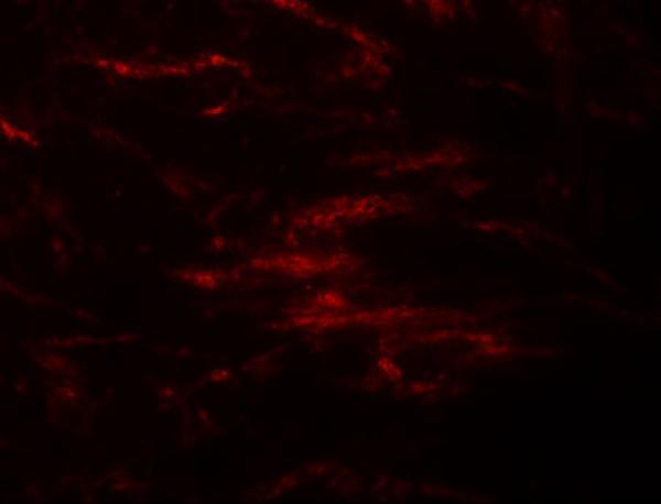 Immunofluorescence of ZIP2 in human brain tissue with ZIP2 antibody at 20 μg/mL