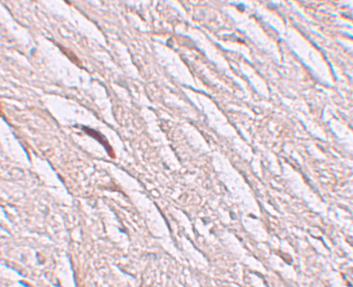Immunohistochemistry of ZIP2 in human brain tissue with ZIP2 antibody at 2