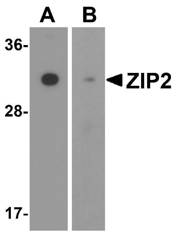 Western blot analysis of ZIP2 in (A) mouse and (B) rat brain tissue lysate with ZIP2 antibody at 1 μg/mL