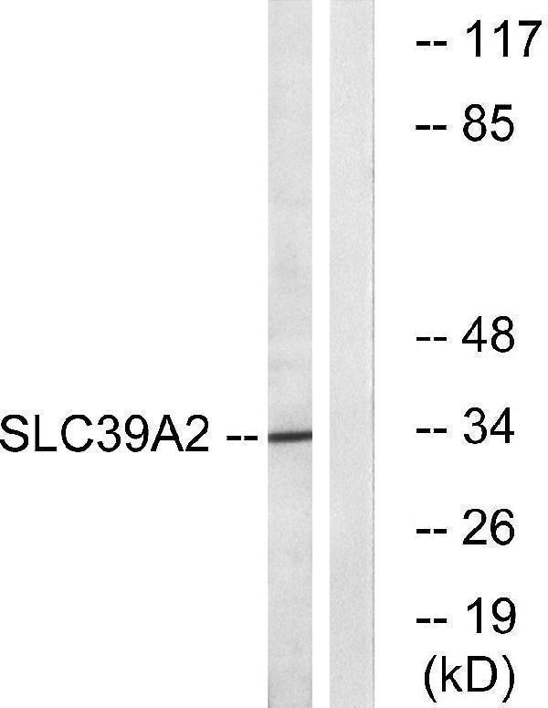 a09140 slc39a2 primary antibodies wb testing 1