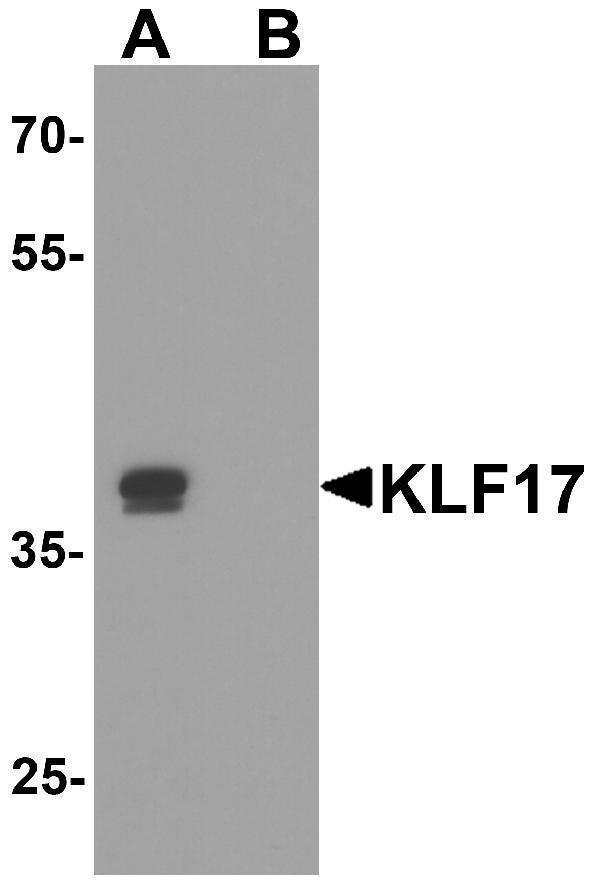 a09147 klf17 primary antibodies wb testing 1