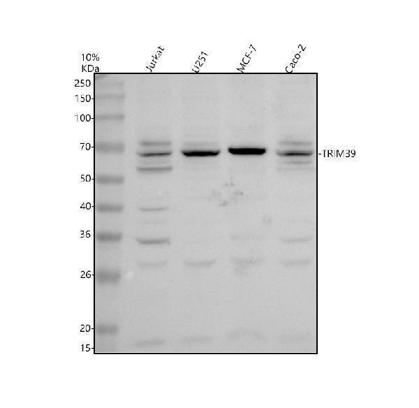 Western blot analysis of TRIM39 using anti-TRIM39 antibody (A09149-1)