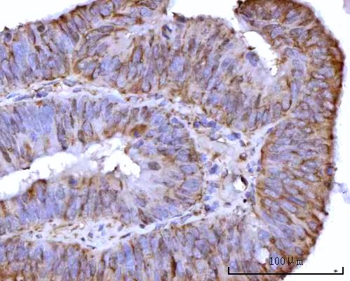  IHC analysis of RPS25 using anti-RPS25 antibody (A09150-3)
