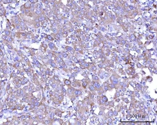  IHC analysis of RPS25 using anti-RPS25 antibody (A09150-3)