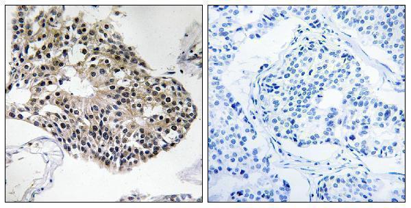 a09150s25 rps25 primary antibodies ihc testing 1