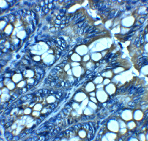 a09158 jagn1 primary antibodies ihc testing 2