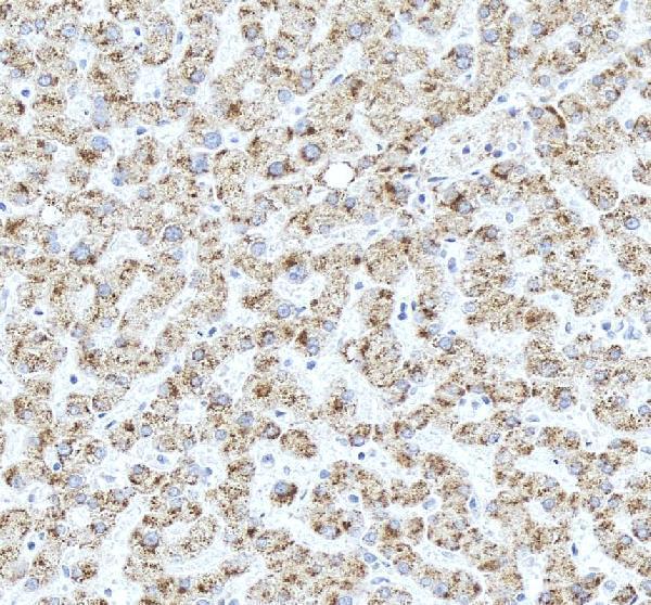 IHC analysis of HAO1 using anti-HAO1 antibody (A09159-2)