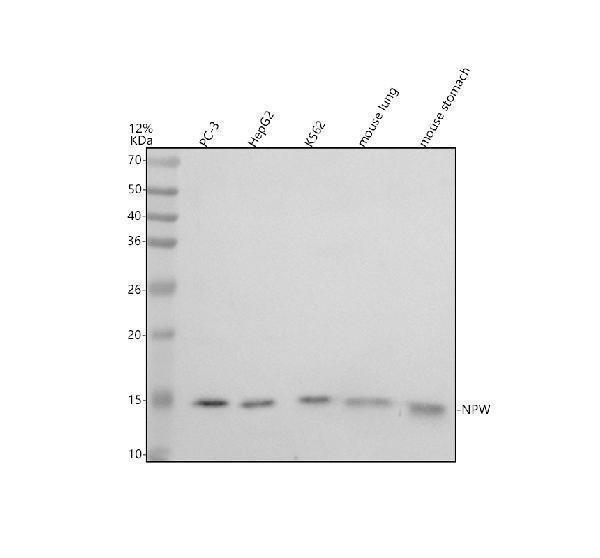 Western blot analysis of NPW using anti-NPW antibody (A09161-1)