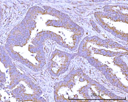  IHC analysis of RPS15A using anti-RPS15A antibody (A09164-1)