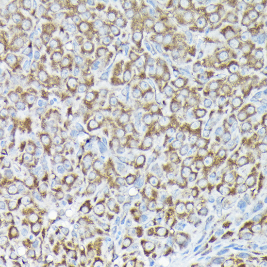 a09164 rps15a primary antiboties ihc testing 2