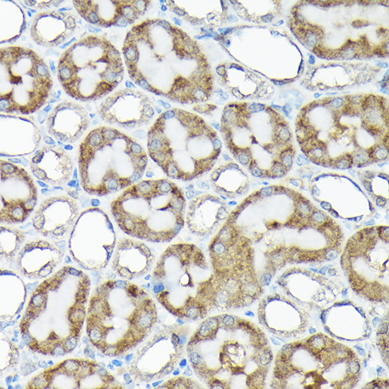 a09164 rps15a primary antiboties ihc testing 3
