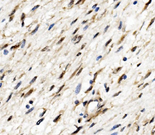 a09168 2 tead2 primary antibodies ihc testing 2