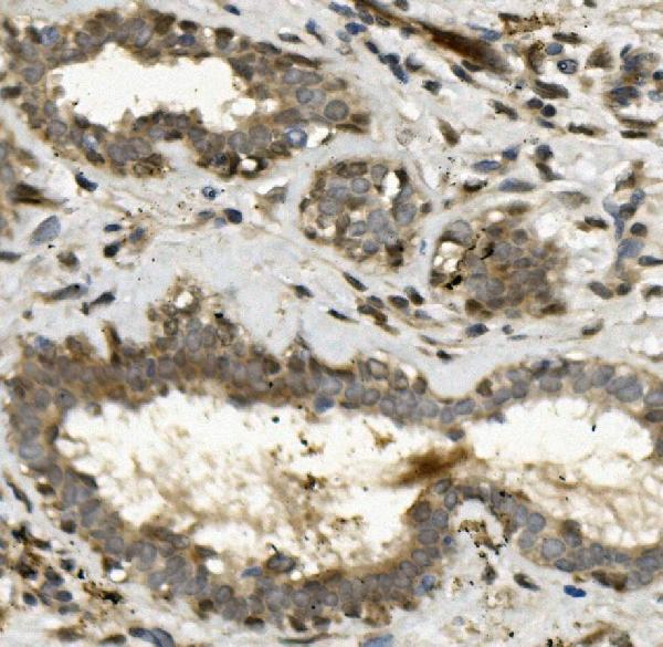 a09168 2 tead2 primary antibodies ihc testing 3