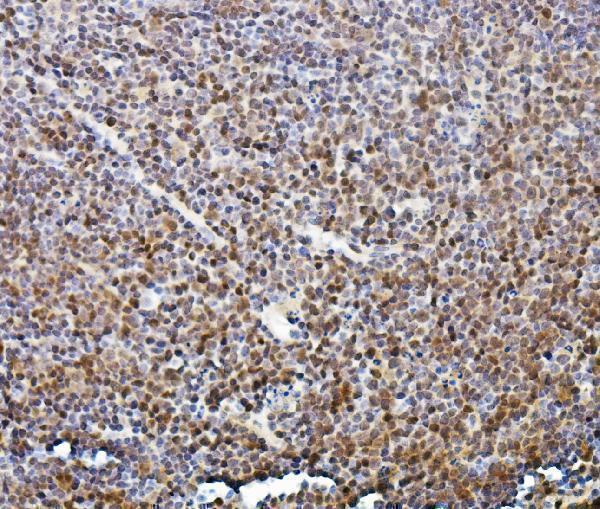 a09168 2 tead2 primary antibodies ihc testing 4