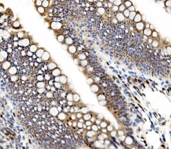 a09168 2 tead2 primary antibodies ihc testing 6