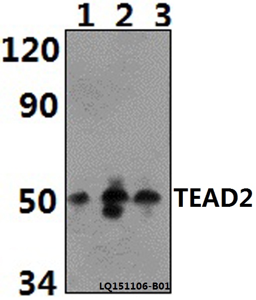 a09168 tead2 primary antiboties wb testing 1