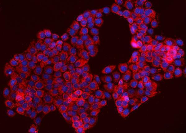 a09172 2 tomm70 primary antibodies if testing 7