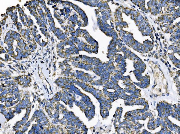 a09172 2 tomm70 primary antibodies ihc testing 3