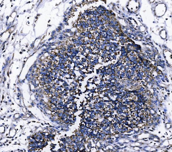 a09172 2 tomm70 primary antibodies ihc testing 4