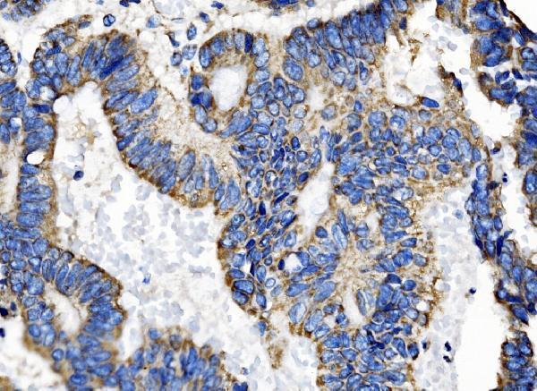 a09172 2 tomm70 primary antibodies ihc testing 6