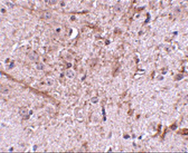 a09172 tomm70a primary antibodies ihc testing 5