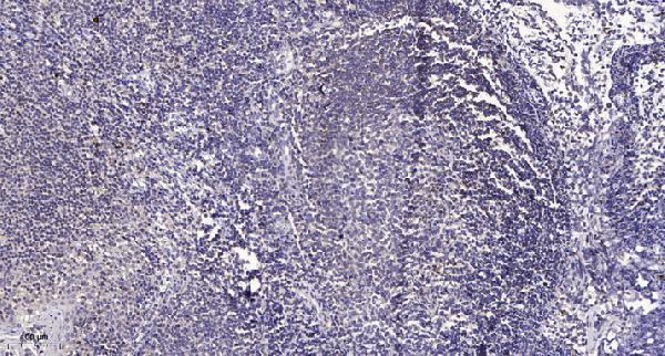Immunohistochemical analysis of paraffin-embedded human tonsil