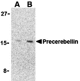 Western blot analysis of precerebellin in 293 cell lysate with precerebellin antibody at (A) 2 and (B) 4 μg/mL
