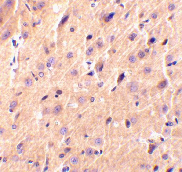 Immunohistochemical staining of rat brain tissue using precerebellin antibody at 2 μg/mL