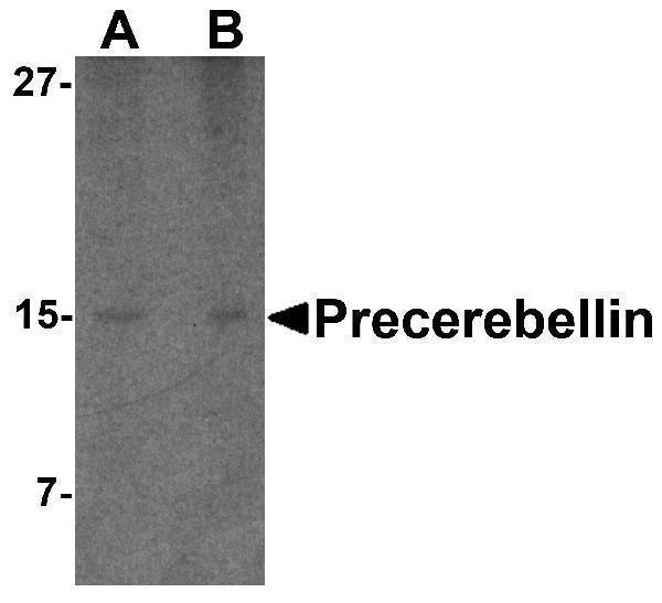 Western blot analysis of precerebellin in mouse cerebellum lysate with precerebellin antibody at (A) 2 and (B) 4 μg/mL