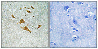 a09177 1 cdk5rap1 primary antibodyes ihc testing 1