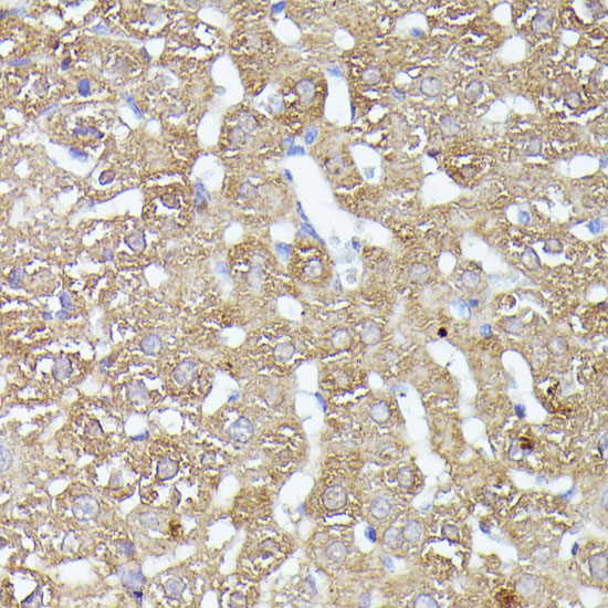 Immunohistochemistry of paraffin-embedded rat liver using CDK5RAP1 antibody  at dilution of 1:100 