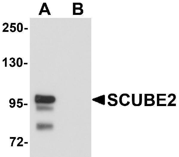 a09179 scube2 primary antibodies wb testing 1