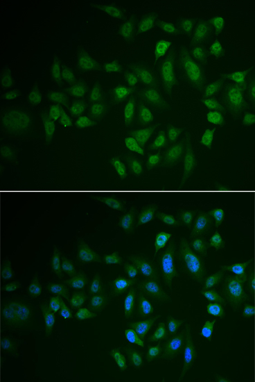 Immunofluorescence analysis of U2OS cells using MYLK3 antibody 