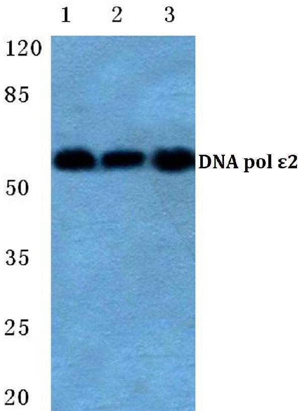 a09182 pole2 primary antiboties wb testing 1