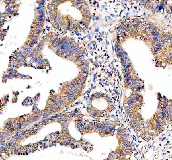  IHC analysis of HTR3E using anti-HTR3E antibody (A09183-1)