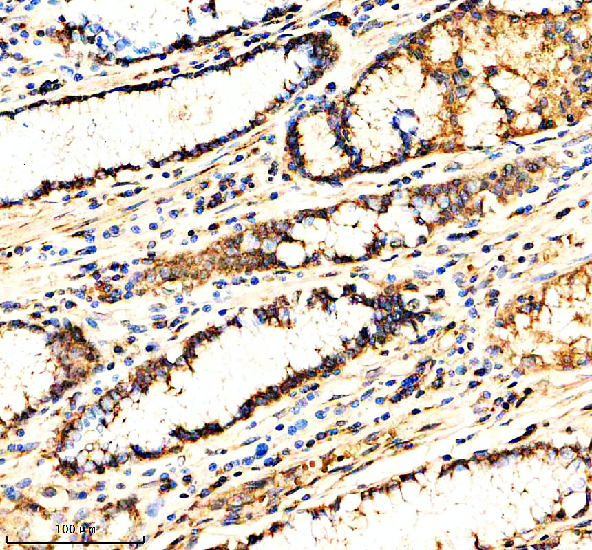 IHC analysis of MAN2A1 using anti-MAN2A1 antibody (A09184-1)