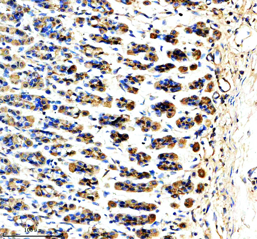 IHC analysis of MAN2A1 using anti-MAN2A1 antibody (A09184-1)