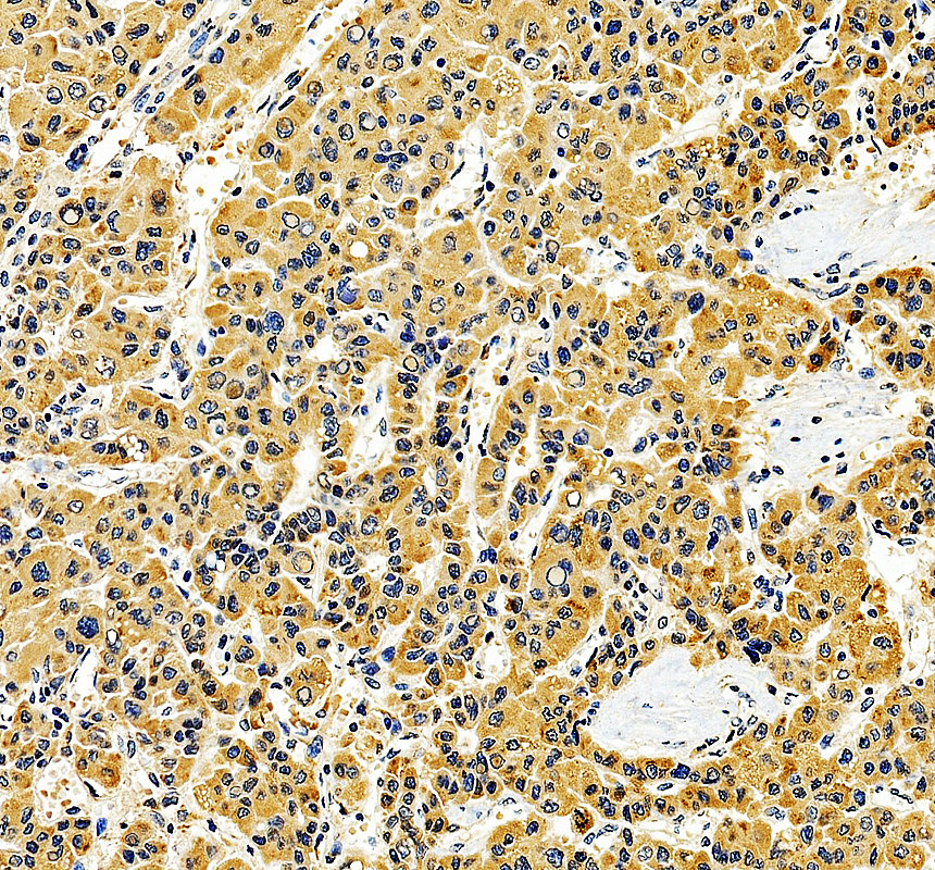 a09184 1 man2a1 primary antibodies ihc testing 3