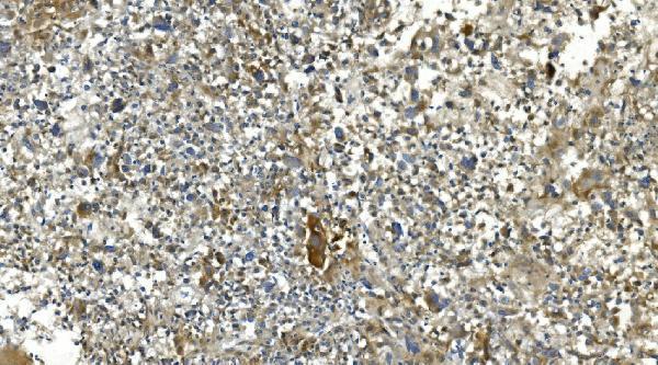 a09186 3 ca13 primary antibodies ihc testing 2