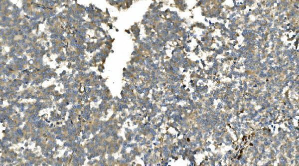 a09186 3 ca13 primary antibodies ihc testing 3