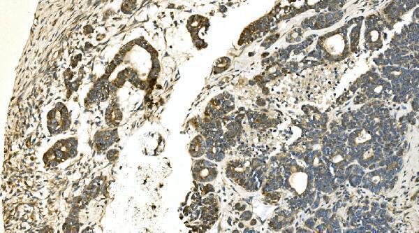 a09186 3 ca13 primary antibodies ihc testing 5
