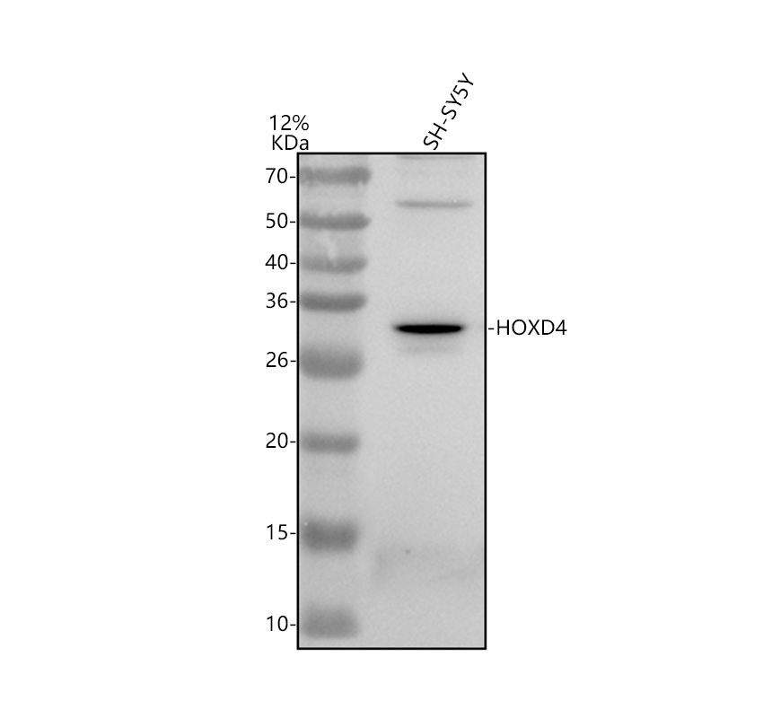 a09189 1 hoxd4 primary antibodies wb testing 1