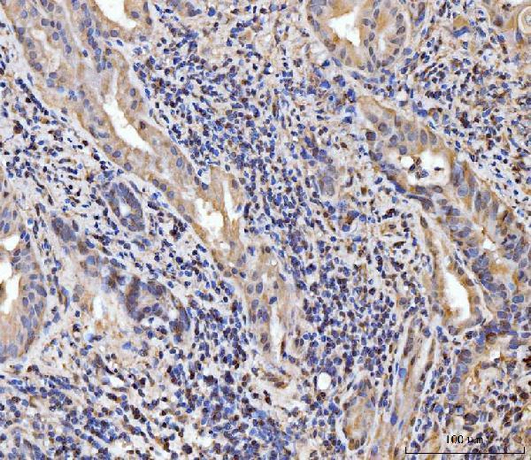  IHC analysis of EXOSC8 using anti-EXOSC8 antibody (A09191-1)