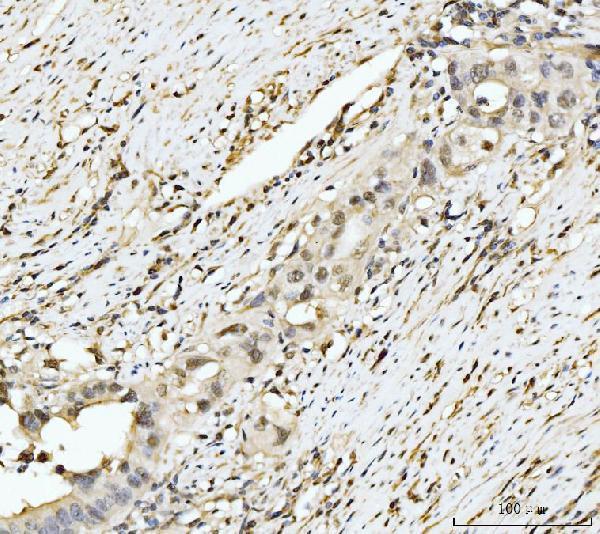  IHC analysis of EXOSC8 using anti-EXOSC8 antibody (A09191-1)