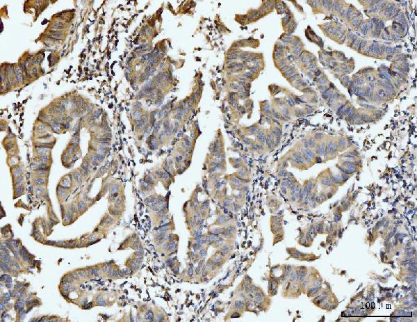 a09191 1 exosc8 primary antibodies ihc testing 5