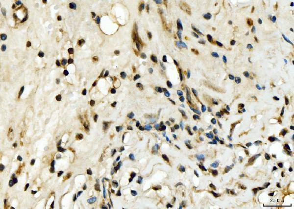 a09191 1 exosc8 primary antibodies ihc testing 8
