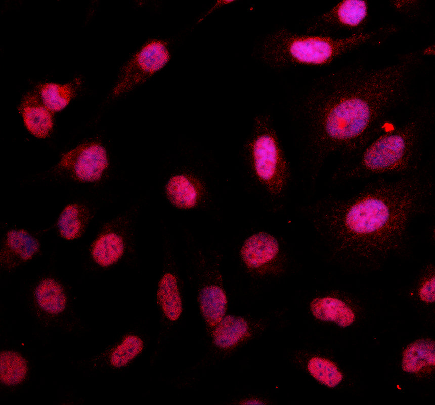 a09194 1 gatad2a primary antibodies if testing 1