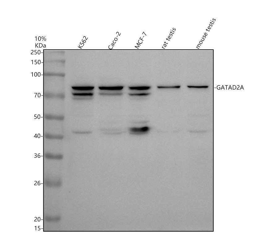 a09194 1 gatad2a primary antibodies wb testing 1