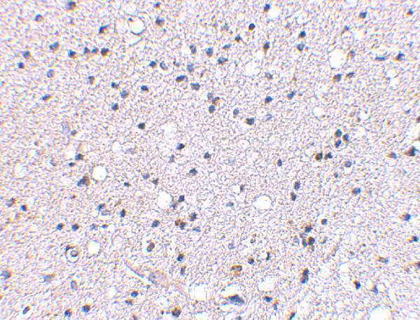 a09195 grik4 primary antibodies ihc testing 2