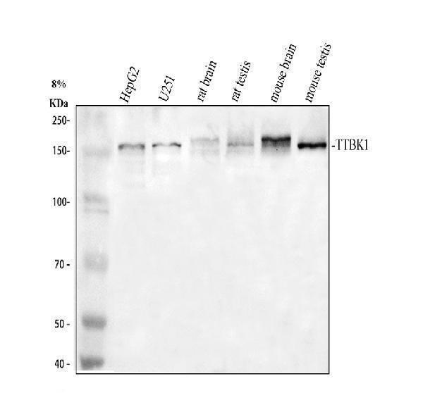 Western blot analysis of TTBK1 using anti-TTBK1 antibody (A09202-2)